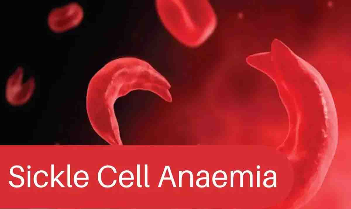 Govt committed to eliminate Sickle Cell Disease by the year 2047 ...