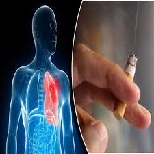 Experts finds rise in cardiac cases among smokers during summers